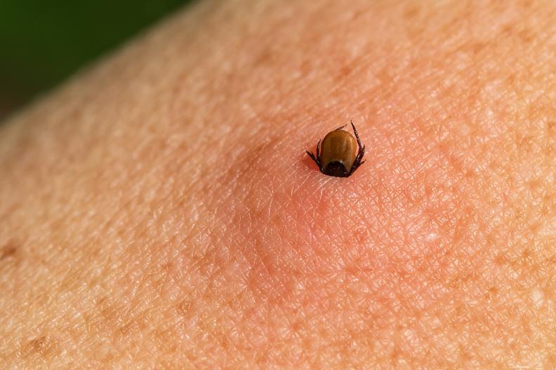 bean tick (Ixodes ricinus) Encephalitis, Lyme disease