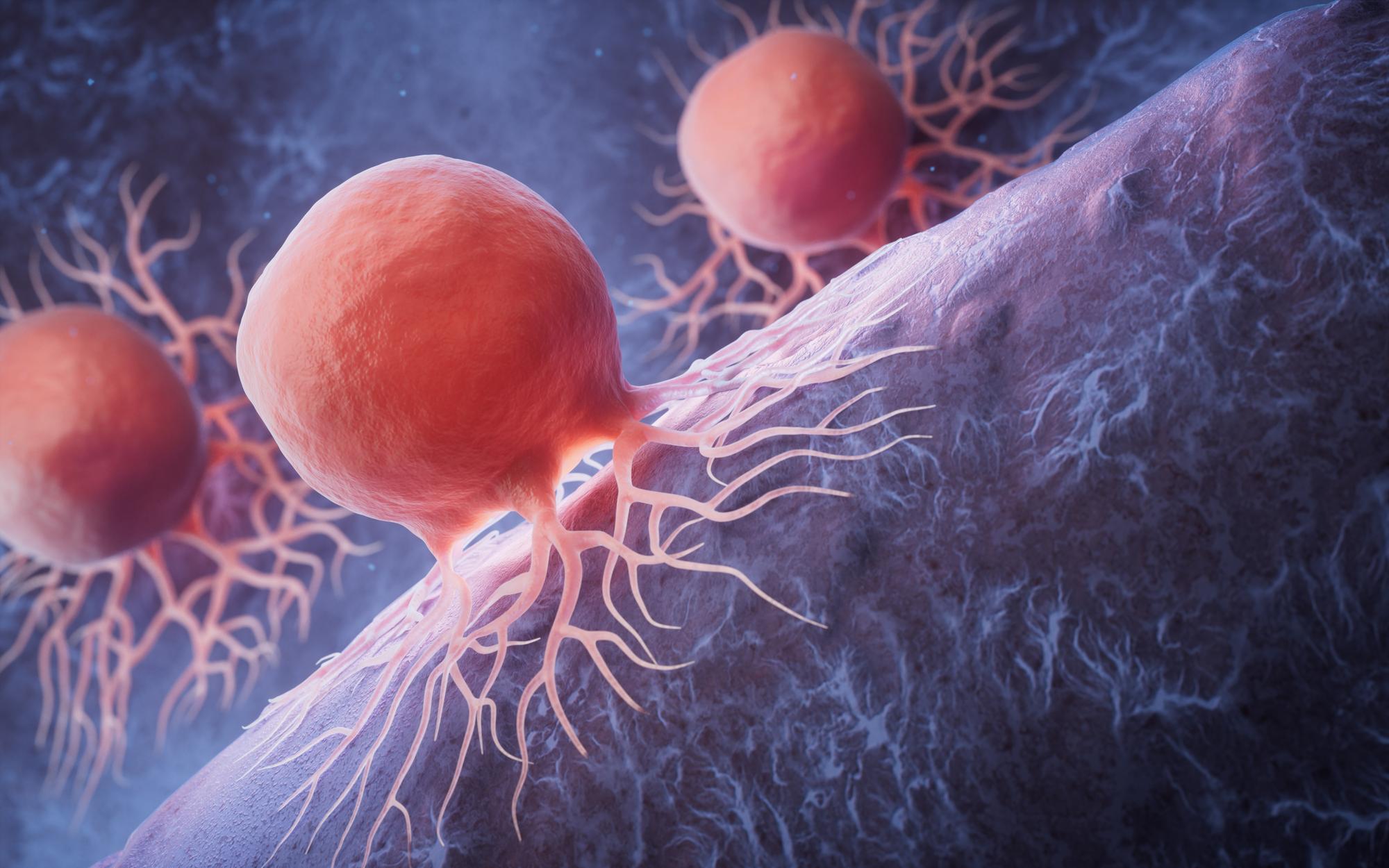 Broccoli sprout induces apoptosis in biological cancer cells — TCMChef Raphael